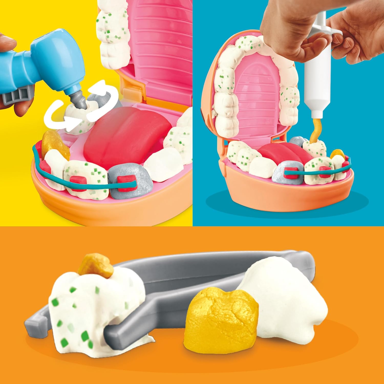 Play-Doh Drill ’n Fill Dentist Toy | Kids Playset with 10 Tools & 8 Cans | Ages 3+